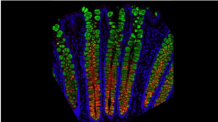 Mapeo del intestino humano con resolución celular