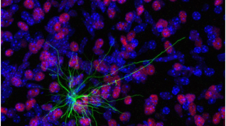 Cómo las células madre hacen un cerebro humano